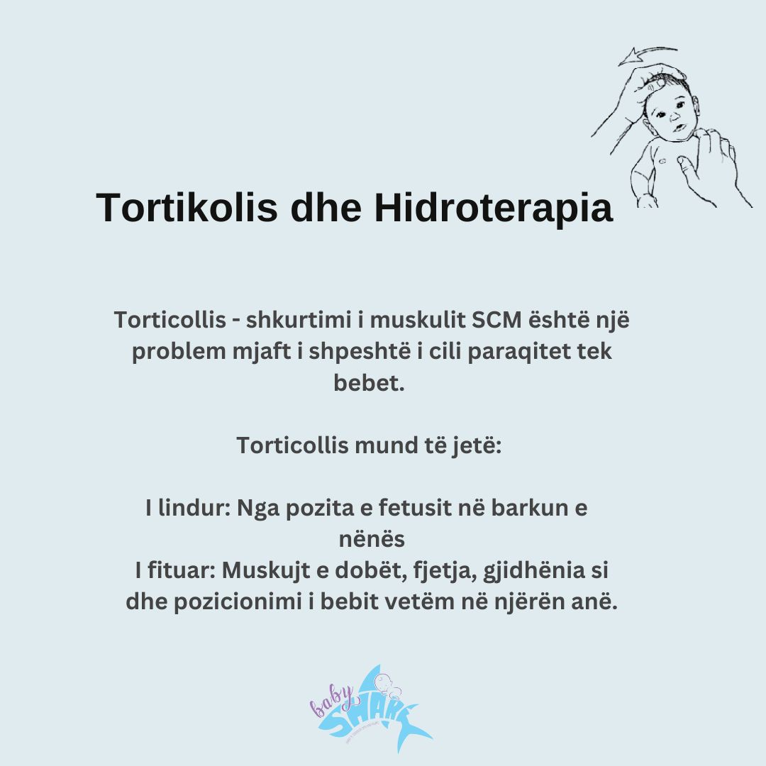 Tortikolis dhe Hidroterapia